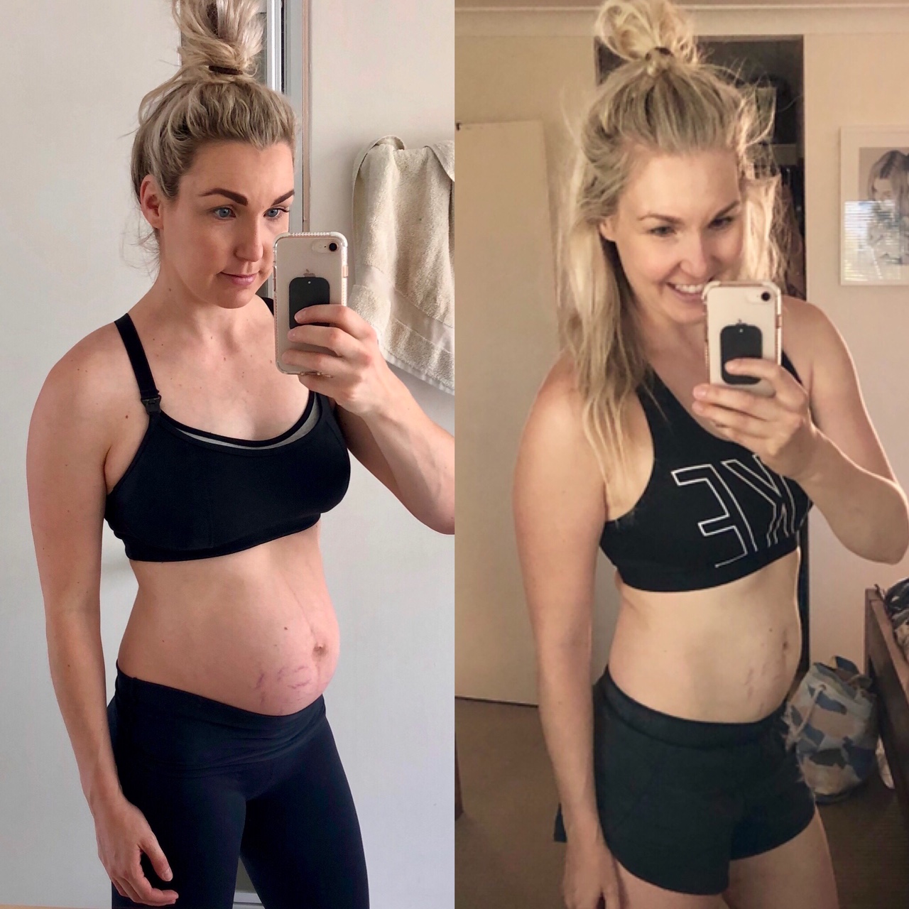 Post-partum weight loss